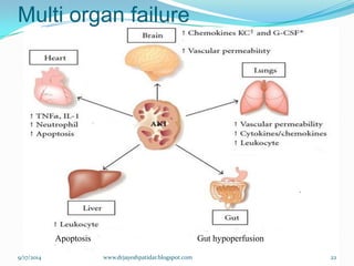 Multi organ failure 
Gut hypoperfusion 
Apoptosis 
9/17/2014 
22 
www.drjayeshpatidar.blogspot.com  