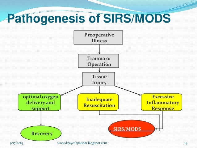 Image result for MULTI ORGAN DYSFUNCTION SYNDROME