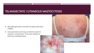 Mast_cells.pptx