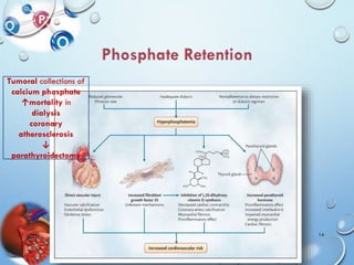 5/23/2014Rehab Rayan & Doaa Hegy 14
Tumoral collections of
calcium phosphate
↑mortality in
dialysis
coronary
atherosclerosis
↓
parathyroidectomy
 
