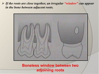 Bone : Basics | PPTX