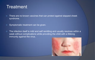 COMMON_VIRAL_INFECTIONS_IN_CHILDREN_AND_ORAL_MANIFESTATIONS.pptx