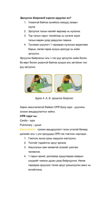 Эргүүлэх байрлалд хэрхэн оруулах вэ?
1. Ухаангүй байгаа хүнийхээ хажууд сөхөрч
сууна.
2. Эргүүлэх талын хөлийг өвдгөөр нь нугална.
3. Тэр талын гарыг тохойгоор нь нугалж эсрэг
талын мөрөн дээр давуулан тавина.
4. Тусламж үзүүлэгч 1 гараараа нугалсан өвдөгнөөс
барьж, нөгөө гараа хүзүүн доогуур нь хийж
эргүүлнэ.
Эргүүлэх байрлалыг аль ч тал руу эргүүлэн хийж болох
ба өөрт болон ухаангүй байгаа хүндээ аль эвтэйхэн тал
руу эргүүлнэ.
Зураг 4. А, Б: эргүүлэх байрлал
Харин амьсгалахгүй байвал CPR буюу зүрх - уушгины
сэхээн амьдруулалтыг хийнэ.
CPR гэдэг нь:
Cardio - зүрх
Pulmonary - уушиг
Resuscitation - сэхээн амьдруулалт гэсэн утгатай бөгөөд
дэлхийн аль ч улс орнуудад CPR гэж товчлон нэрлэдэг.
1. Гэмтсэн хүнээ дээш харуулж хэвтүүлнэ.
2. Толгойг гэдийлгэн эрүүг өргөнө.
3. Амьсгалын зам чөлөөтэй эсэхийг шалгаж
чөлөөлнө.
4. 1 гарын эрхий, долоовор хуруугаараа хамрын
үзүүрийг чимхэн духан дээр байрлуулна. Нөгөө
гараараа эрүүнээс татаж эрүүг дээшлүүлэн амыг нь
ангайлгана.
 