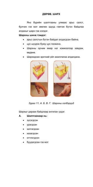 ДӨРӨВ. ШАРХ
Янз бүрийн шалтгааны улмаас арьс салст,
булчин гэх мэт зөөлөн эдүүд гэмтэж бүтэн байдлаа
алдахыг шарх гэж хэлдэг.
Шархны шинж тэмдэг:
• арьс салстын бүтэн байдал алдагдсан байна.
• цус шүүрэх буюу цус гоожино.
• Шархны орчим ямар нэг хэмжээгээр хавдаж,
өвдөнө.
• Шархадсан эрхтний үйл ажиллагаа алдагдана.
Зураг 11. А. Б. В. Г: Шархны хэлбэрүүд
Шархыг дараах байдлаар ангилан үздэг.
А. Шалтгаанаар нь:
• зүсэгдсэн
• урагдсан
• хатгагдсан
• хазагдсан
• огтлогдсон
• буудагдсан гэх мэт
 