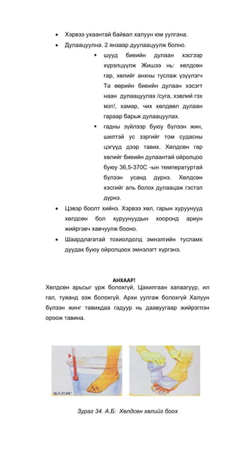 • Хэрвээ ухаантай байвал халуун юм уулгана.
• Дулаацуулна. 2 янзаар дуулаацуулж болно.
шууд биеийн дулаан хэсгээр
хүрэлцүүлж Жишээ нь: хөлдсөн
гар, хөлийг анхны туслаж үзүүлэгч
Та өөрийн биеийн дулаан хэсэгт
наан дулаацуулах /суга, хэвлий гэх
мэт/, хамар, чих хөлдвөл дулаан
гараар барьж дулаацуулах.
гадны зүйлээр буюу бүлээн жин,
шилтэй ус зэргийг том судасны
цэгүүд дээр тавих. Хөлдсөн гар
хөлийг биеийн дулаантай ойролцоо
буюу 36,5-370С -ын температуртай
бүлээн усанд дүрнэ. Хөлдсөн
хэсгийг аль болох дулаацаж гэстэл
дүрнэ.
• Цэвэр боолт хийнэ. Хэрвээ хөл, гарын хуруунууд
хөлдсөн бол хуруунуудын хооронд ариун
жийргэвч хавчуулж бооно.
• Шаардлагатай тохиолдолд эмнэлгийн тусламх
дуудах буюу ойролцоох эмнэлэгт хүргэнэ.
АНХААР! 
Хөлдсөн арьсыг үрж болохгүй, Цахилгаан хапаагуур, ил
гал, туяанд ээж болохгүй. Архи уулгаж болохгүй Халуун
бүлээн жинг тавихдаа гадуур нь даавуугаар жийрэглэн
ороож тавина.
Зураг 34. А.Б: Хөлдсөн хөлийг боох
 