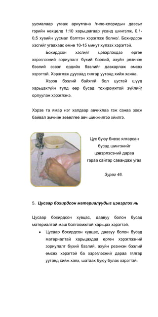 уусмалаар угааж ариутгана /гипо-хлоридын давсыг
гэрийн нөхцөлд 1:10 харьцаагаар усанд шингэлж, 0,1-
0,5 хувийн уусмал бэлтгэн хэрэглэж болно/. Бохирдсон
хэсгийг угаахаас өмнө 10-15 минут хүлээх хэрэгтэй.
Бохирдсон хэсгийг цэвэрлэхдээ өргөн
хэрэглээний зориулалт бүхий бээлий, ахуйн резинэн
бээлий эсвэл ердийн бээлийг давхарлаж өмсөх
хэрэгтэй. Хэрэглэж дуусаад гялгар уутанд хийж хаяна.
Хэрэв бээлий байхгүй бол цустай шууд
харьцахгүйн тулд өөр бусад тохиромжтой зүйлийг
орлуулан хэрэглэнэ.
Хэрэв та ямар нэг халдвар авчихлаа гэж санаа зовж
байвал эмчийн зөвөлгөө авч шинжилгээ хйилгэ.
Цус буюу биеэс ялгарсан
бусад шингэнийг
цэвэрлэсэний дараа
гараа сайтар савандаж угаа
Зураг 46.
5. Цусаар бохирдсон материалуудыг цэвэрлэх нь
Цусаар бохирдсон хувцас, даавуу болон бусад
материалтай маш болгоомжтой харьцах хэрэгтэй.
• Цусаар бохирдсон хувцас, даавуу болон бусад
материалтай харьцахдаа өргөн хэрэглээний
зориулалт бүхий бээлий, ахуйн резинэн бээлий
өмсөх хэрэгтэй ба хэрэглэсний дараа гялгар
уутанд хийж хаях, шатаах буюу булах хэрэгтэй.
 