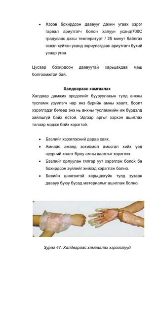 • Хэрэв бохирдсон даавууг дахин угаах хэрэг
гарвал ариутгагч болон халуун усанд/700С
градусаас дээш температурт / 25 минут байлгах
эсвэл хүйтэн усанд зориулагдсан ариутгагч бүхий
усаар угаа.
Цусаар бохирдсон даавуутай харьцахдаа маш
болгоомжтой бай.
Халдвараас хамгаалах
Халдвар дамжих эрсдэлийг бууруулахын тулд анхны
тусламж үзүүлэгч нар янз бүрийн амны хаалт, боолт
хэрэглэдэг бөгөөд энэ нь анхны тусламжийн иж бүрдэлд
зайлшгүй байх ёстой. Эдгээр аргыг хэрхэн ашиглах
талаар мэдэж байх хэрэгтэй.
• Бээлийг хэрэглэсний дараа хаях.
• Амнаас аманд зохиомол амьсгал хийх үед
нүүрний хаалт буюу амны хаалтыг хэрэглэх.
• Бээлийг орлуулан гялгар уут хэрэглэж болох ба
бохирдсон зүйлийг хийхэд хэрэглэж болно.
• Биеийн шингэнтэй харьцахгүйн тулд зузаан
даавуу буюу бусад материалыг ашиглаж болно.
Зураг 47. Халдвараас хамгаалах хэрэгслүүд
 