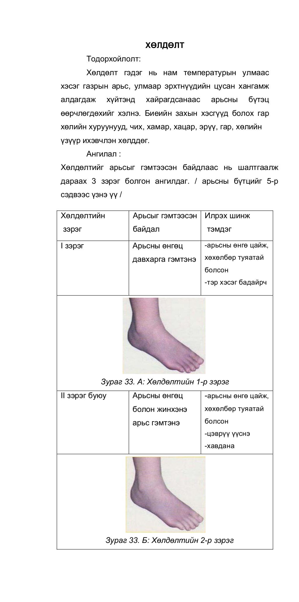Осол гэмтлийн үед үзүүлэх анхны тусламж