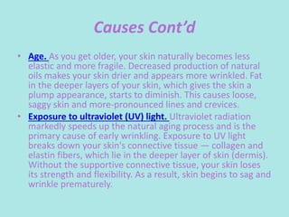 Causes Cont’d
• Age. As you get older, your skin naturally becomes less
elastic and more fragile. Decreased production of natural
oils makes your skin drier and appears more wrinkled. Fat
in the deeper layers of your skin, which gives the skin a
plump appearance, starts to diminish. This causes loose,
saggy skin and more-pronounced lines and crevices.
• Exposure to ultraviolet (UV) light. Ultraviolet radiation
markedly speeds up the natural aging process and is the
primary cause of early wrinkling. Exposure to UV light
breaks down your skin's connective tissue — collagen and
elastin fibers, which lie in the deeper layer of skin (dermis).
Without the supportive connective tissue, your skin loses
its strength and flexibility. As a result, skin begins to sag and
wrinkle prematurely.
 