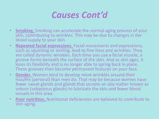 Causes Cont’d
• Smoking. Smoking can accelerate the normal aging process of your
skin, contributing to wrinkles. This may be due to changes in the
blood supply to your skin.
• Repeated facial expressions. Facial movements and expressions,
such as squinting or smiling, lead to fine lines and wrinkles. They
are called dynamic wrinkles. Each time you use a facial muscle, a
groove forms beneath the surface of the skin. And as skin ages, it
loses its flexibility and is no longer able to spring back in place.
These grooves then become permanent features on your face.
• Gender. Women tend to develop more wrinkles around their
mouths (perioral) than men do. That may be because women have
fewer sweat glands and glands that secrete an oily matter known as
sebum (sebaceous glands) to lubricate the skin and fewer blood
vessels in this area.
• Poor nutrition. Nutritional deficiencies are believed to contribute to
skin aging.
 