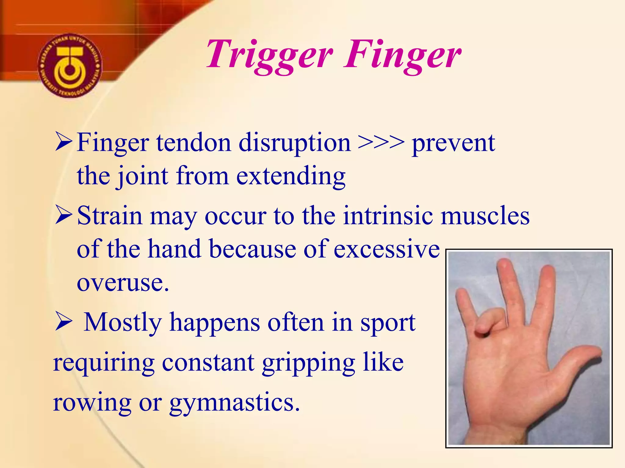 Sport Injuries - Wrist and Fingers Injuries | PPTX