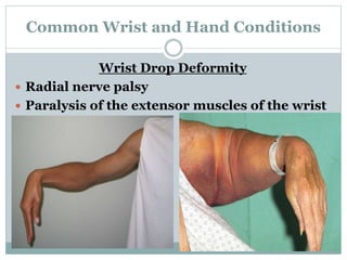 Wrist and Hand - a Review | PPTX