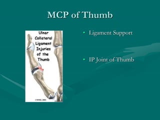 MCP of Thumb
• Ligament Support
• IP Joint of Thumb
 