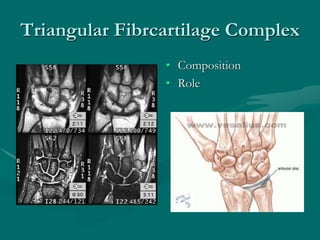 Triangular Fibrcartilage Complex
• Composition
• Role
 