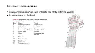 Extensor Zone 4 Wrist and Hand Management.pptx