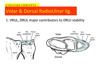 EVOLVING CONCEPTS

Volar & Dorsal RadioUlnar lig.
1. VRUL, DRUL major contributors to DRUJ stability
 