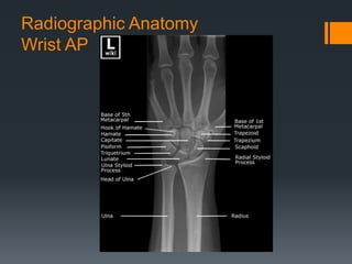 Radiographic Anatomy
Wrist AP
 