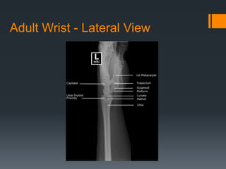 Adult Wrist - Lateral View
 