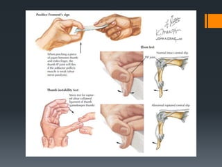 Wrist and hand examination