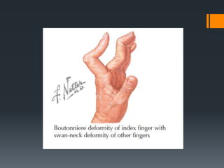 Wrist and hand examination