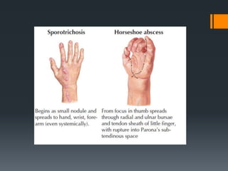 Wrist and hand examination