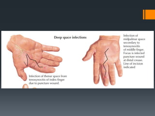 Wrist and hand examination