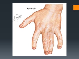 Wrist and hand examination