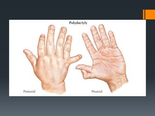 Wrist and hand examination