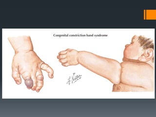 Wrist and hand examination