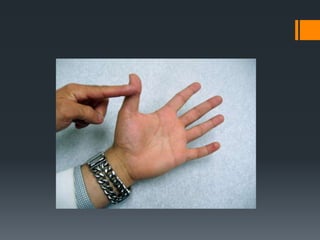 Wrist and hand examination