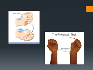 Wrist and hand examination