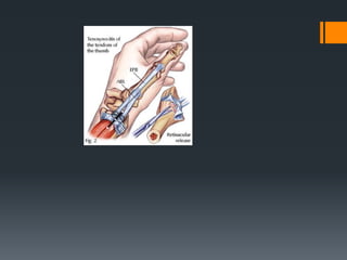 Wrist and hand examination