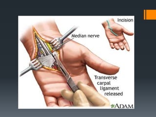 Wrist and hand examination