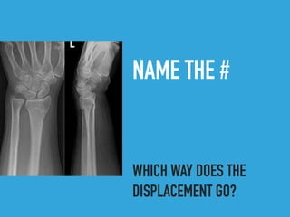 NAME THE #
WHICH WAY DOES THE
DISPLACEMENT GO?
 