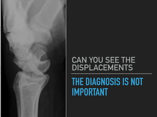 THE DIAGNOSIS IS NOT
IMPORTANT
CAN YOU SEE THE
DISPLACEMENTS
 