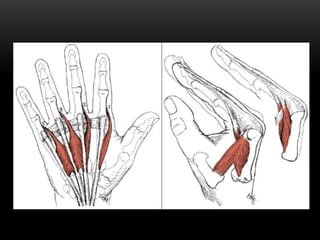 • Other 3 muscles are located dorsoradially.
• EPB & APL – common course – dorsal forearm – 1st dorsal
compartment-radial ...