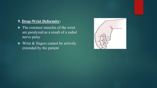 forearm, Wrist, hand joint anatomy & examination | PPTX