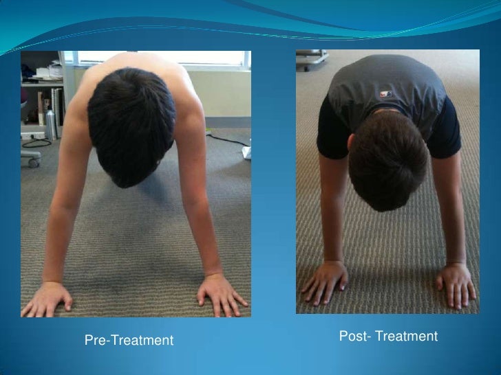 Wrist Injuries In Gymnast