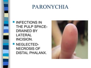 Incision Finger Pulp WRIST JOINT AND JOINTS IN THE HAND WITH APPLIED ASPECTS | PPT