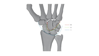 Comprehensive Overview of the Wrist Joint Anatomy, Movements, and ...