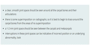 Comprehensive Overview of the Wrist Joint Anatomy, Movements, and ...