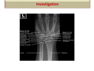 Investigation
X-RAY
 