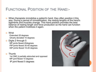 Wrist joint complex | PPTX