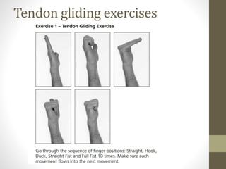 Tendon gliding exercises
 