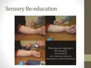 Sensory Re-education
 