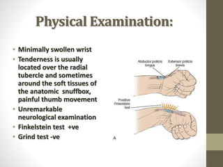 Physical Examination:
• Minimally swollen wrist
• Tenderness is usually
located over the radial
tubercle and sometimes
around the soft tissues of
the anatomic snuffbox,
painful thumb movement
• Unremarkable
neurological examination
• Finkelstein test +ve
• Grind test -ve
 