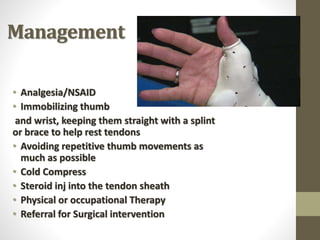 Management
• Analgesia/NSAID
• Immobilizing thumb
and wrist, keeping them straight with a splint
or brace to help rest tendons
• Avoiding repetitive thumb movements as
much as possible
• Cold Compress
• Steroid inj into the tendon sheath
• Physical or occupational Therapy
• Referral for Surgical intervention
 