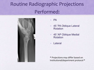 Wrist Lateral Rotation Wrist presentation | PPTX
