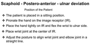 WRIST RADIOGRAPHY , Bathmahariswaran (1).pptx