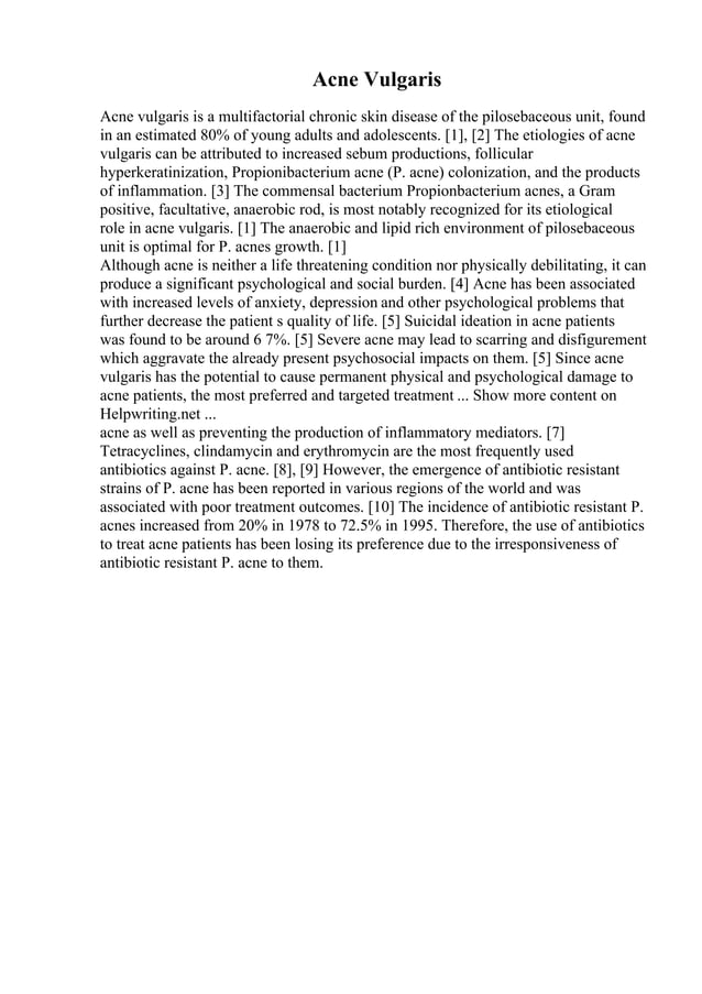 writing-a-comparison-essay-pdf